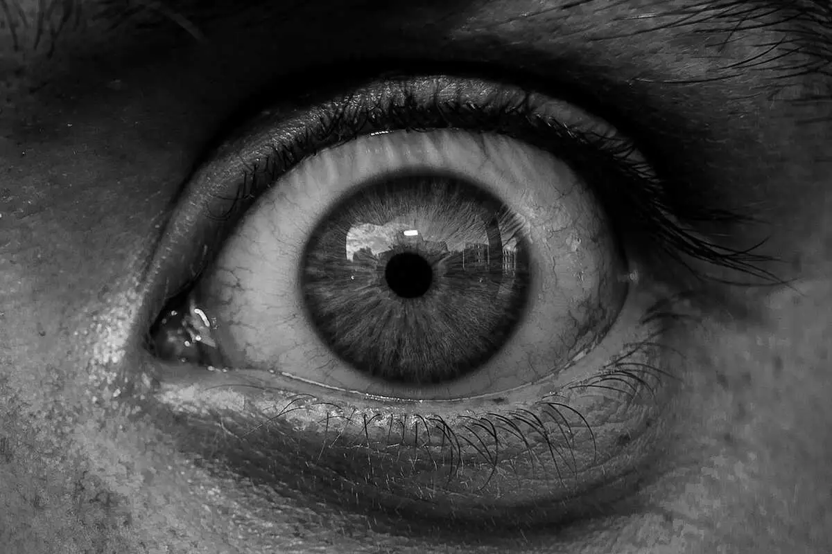 You are currently viewing Blurry Vision Treatment: Effective Remedies and Solutions