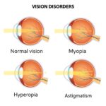 Refractive errors in Ghana.